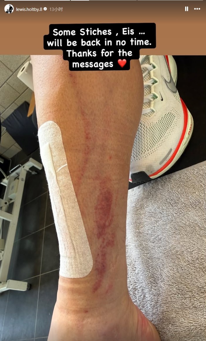 NBA免费视频-慎入！前德甲球员霍尔特比荷甲遭遇凶狠犯规，脚被划开一道口子